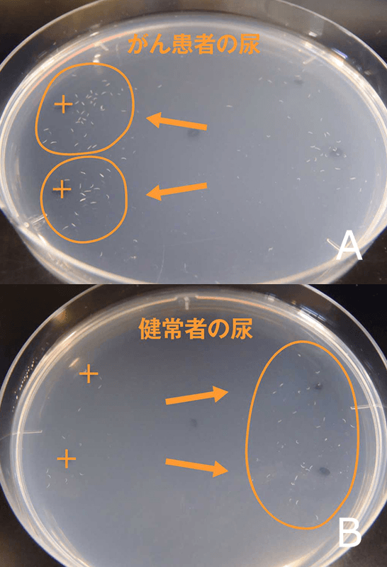 nematode-health-diagnosis-one-drop-of-urine-cancer-care