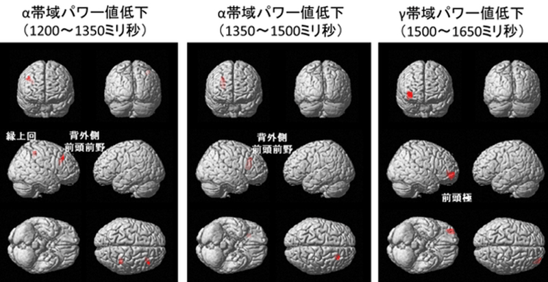 specific-brain-area-involved-in-fatigue