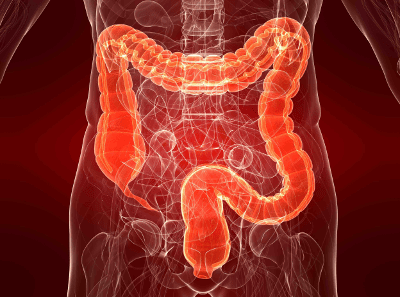 cancer-on-left-side-colon-patients-survive-longer-than-right-side