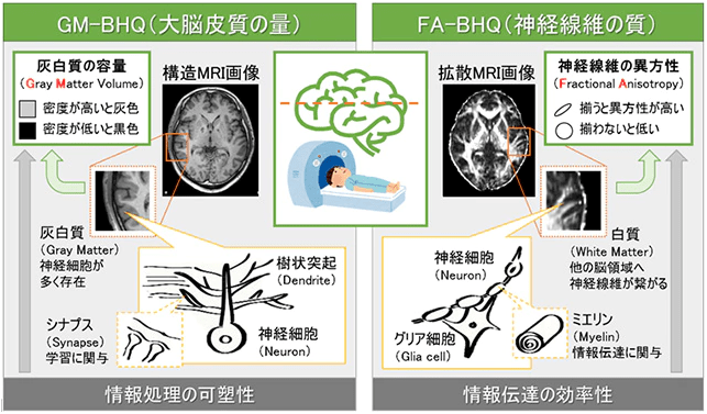 high-cocoa-chocolate-increases-amount-of-cerebral-cortex