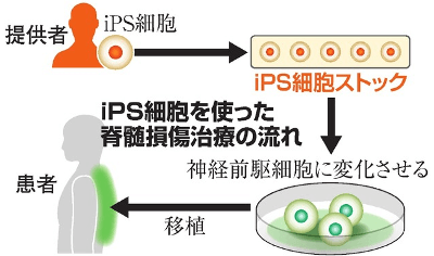 ips-cells-to-treat-spinal-cord-injury